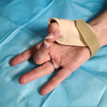 Custom thumb splint